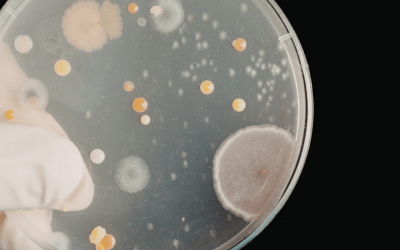 Yeast Overgrowth: Could Candida Be Running the Show in Your Gut?